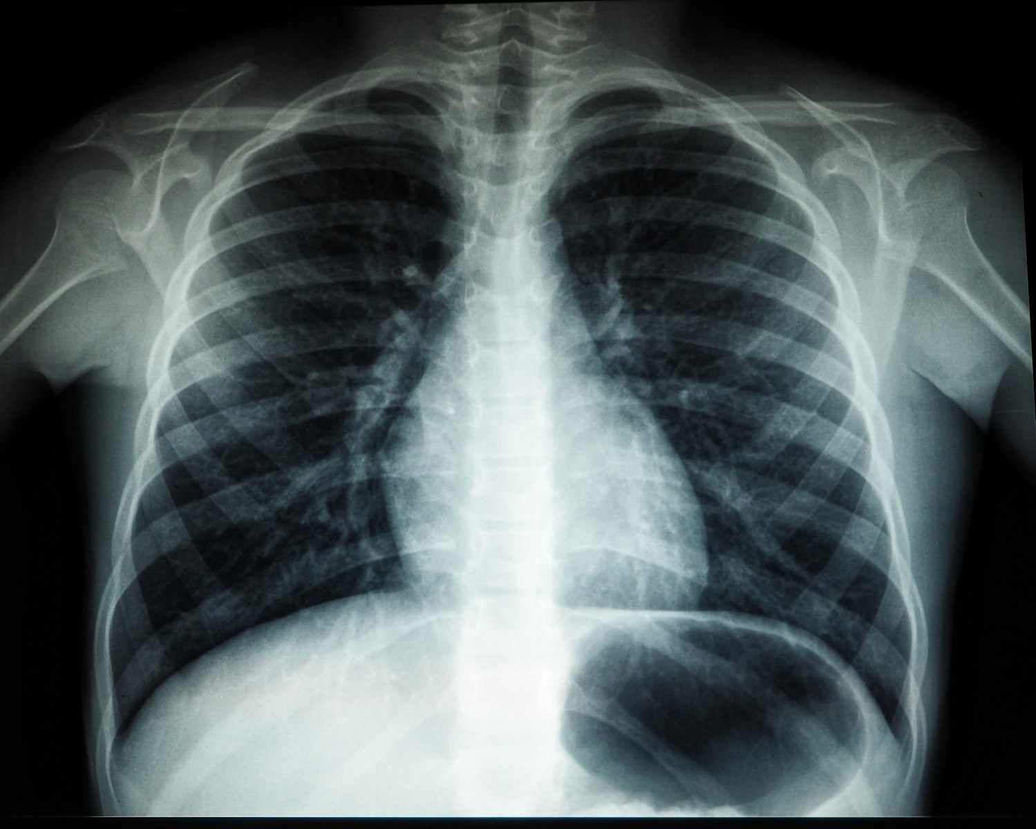 Medical Imaging and Radiography